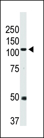 BMPR2 Antibody