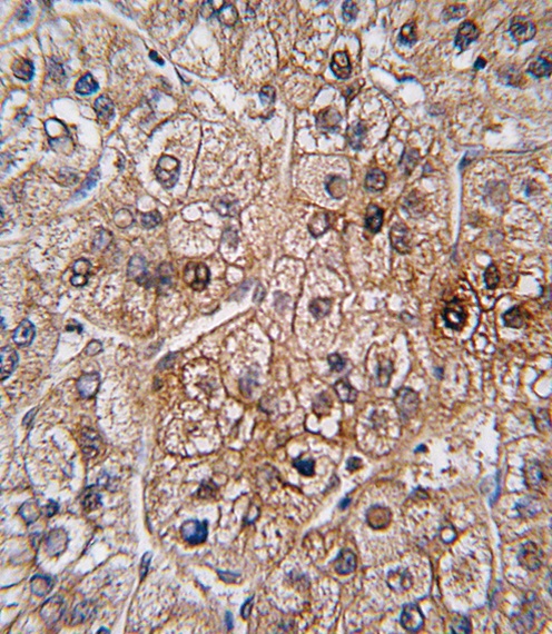 BMPR2 Antibody