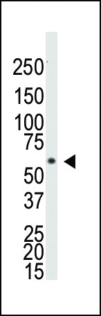 BMPR1A Antibody