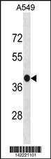 C5AR2 Antibody