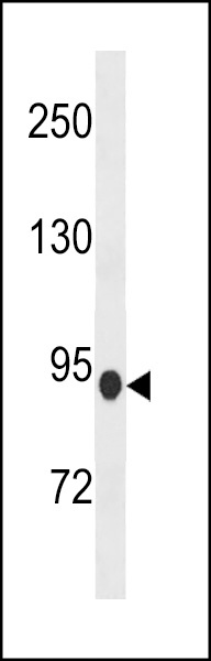 PDE8B Antibody