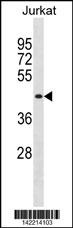 MBNL1 Antibody