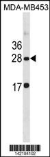 CLDN14 Antibody