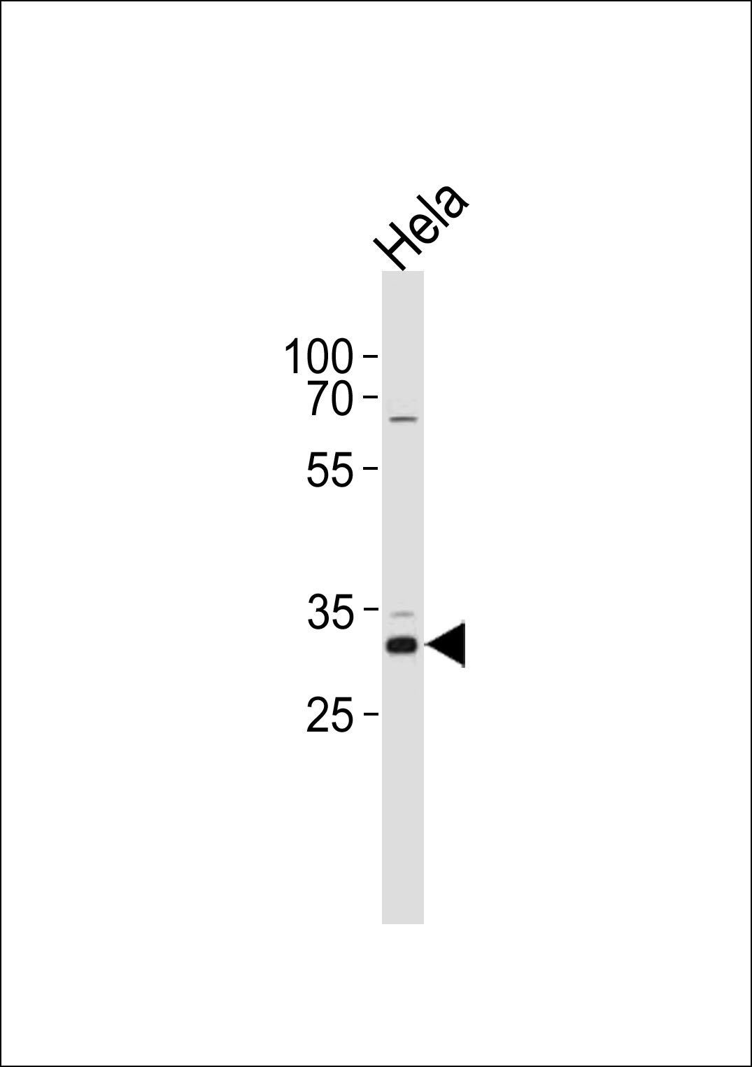 CCND1 Antibody