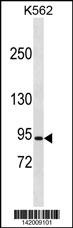 CLCN5 Antibody