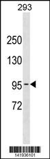 POLK Antibody
