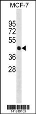 PPM1F Antibody