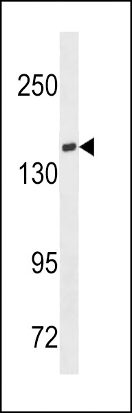 TIAM1 Antibody