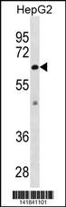 ZMPSTE24 Antibody