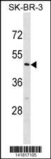 CASQ2 Antibody