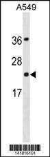 PDCD6 Antibody
