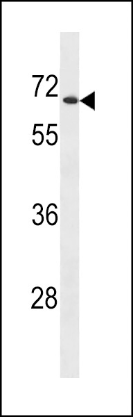 UGT2B28 Antibody