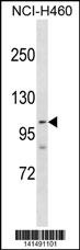 PARP1 Antibody