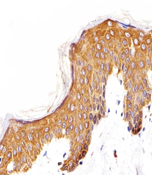 EGFR Antibody