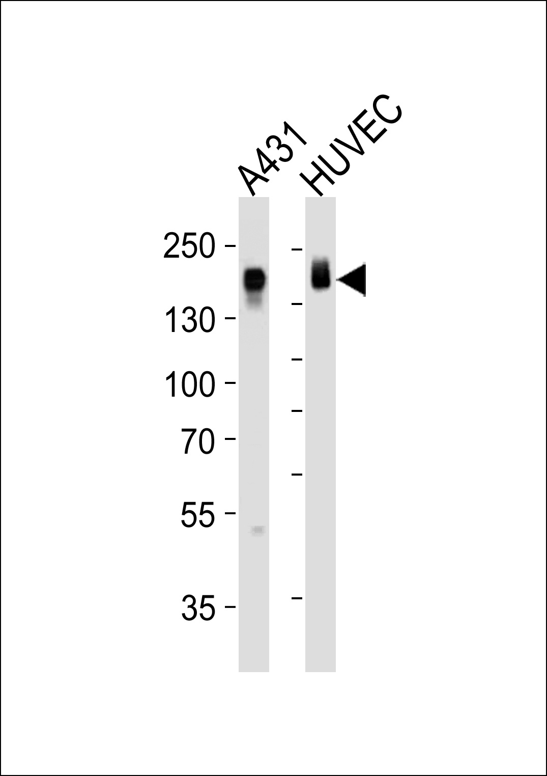EGFR Antibody