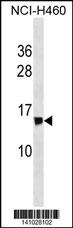 NDUFS6 Antibody