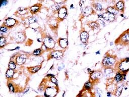 ZNF395 Antibody