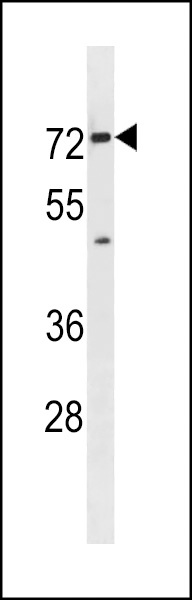 Slc5a8 Antibody
