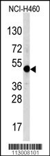 TFAP2A Antibody