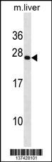 PRRX2 Antibody