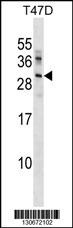 UBE2R2 Antibody