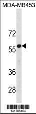 UGT2B4 Antibody