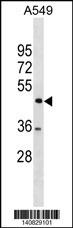 TSPYL1 Antibody