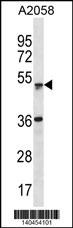 ZSCAN21 Antibody
