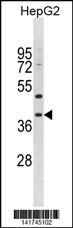 MPPED1 Antibody