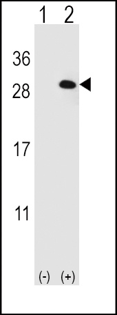 EIF4E2 Antibody