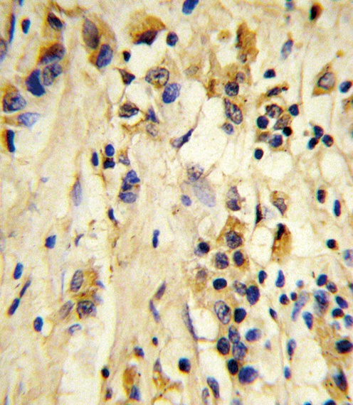 EIF4E2 Antibody