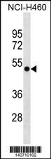 GTPBP3 Antibody