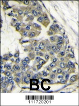 EIF4B Antibody