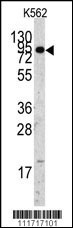 EIF4B Antibody