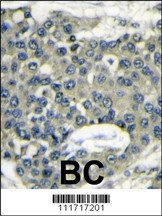 EIF4B Antibody