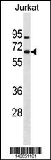 ZNF358 Antibody