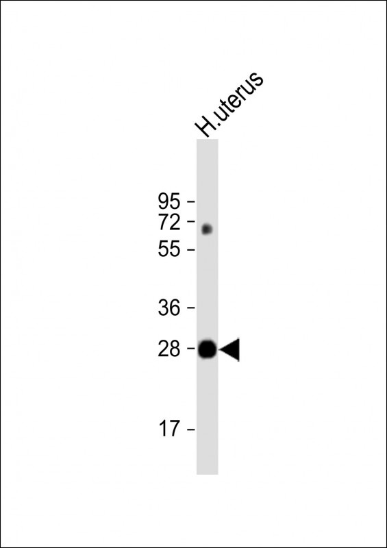 VGLL4 Antibody