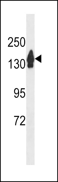 RECQL4 Antibody