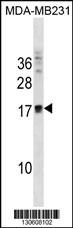 ANKRD37 Antibody