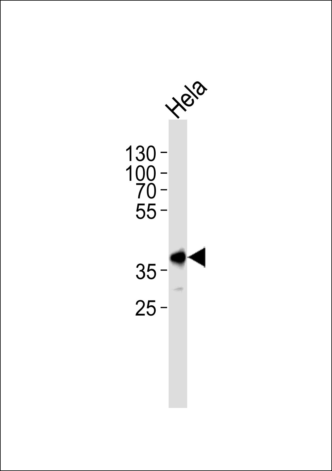 Pbk Antibody