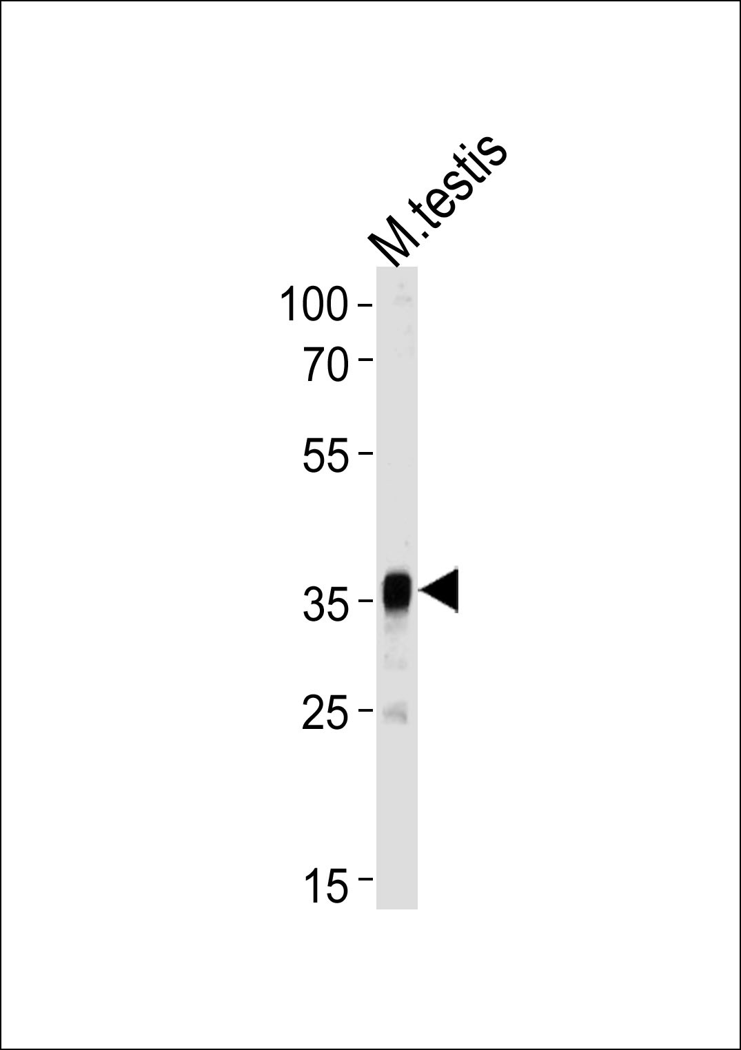 Mouse Pbk Antibody
