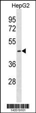CTNS Antibody
