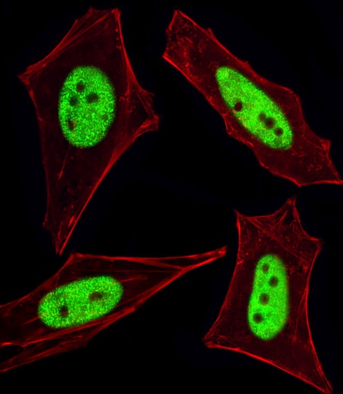 Cellular Apoptosis Susceptibility Antibody