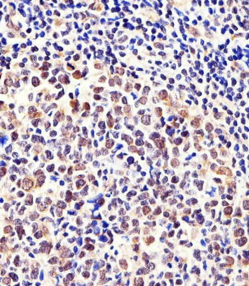 Cellular Apoptosis Susceptibility Antibody