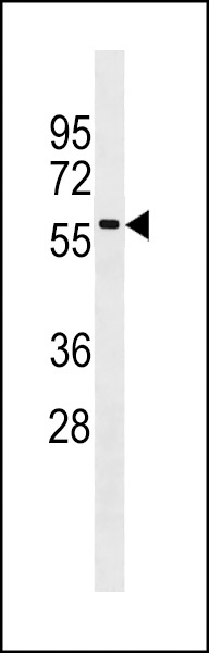 RABEPK Antibody