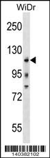 KIT Antibody