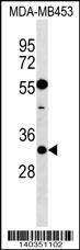 KCNIP2 Antibody