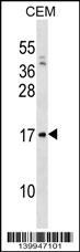 VPREB1 Antibody