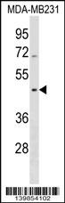 SEPT12 Antibody