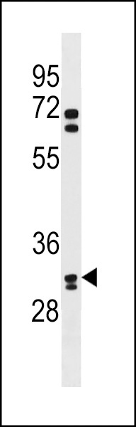 OR6B2 Antibody